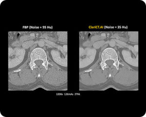 Computed Tomography-AI-image