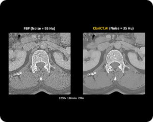 CT-AI-Scan