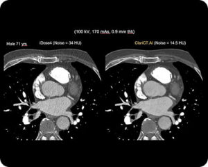 Computed Tomography-image