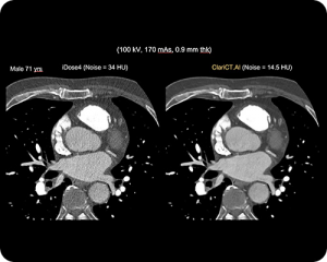 CT-Scan