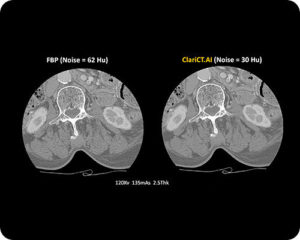 Computed Tomography-image
