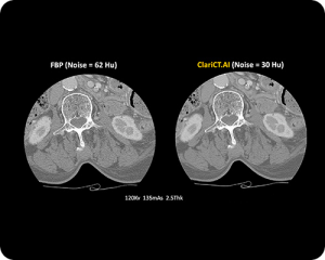 CT-AI-Scan
