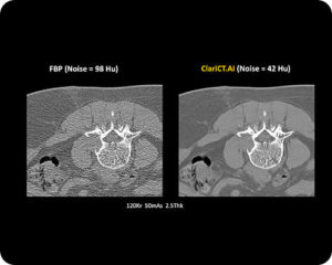 Computed Tomography-image