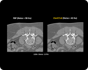 CT-AI-Scan