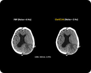 Computed Tomography-image