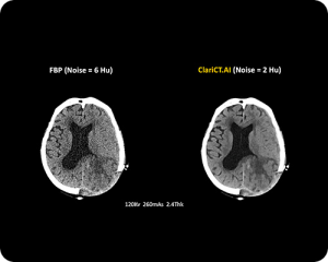 CT-AI-Scan