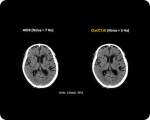 Computed Tomography-image