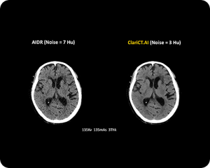 CT-AI-Scan