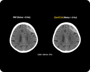 Computed Tomography-image