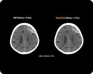 CT-Scan
