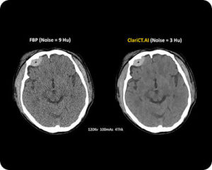 Computed Tomography-image