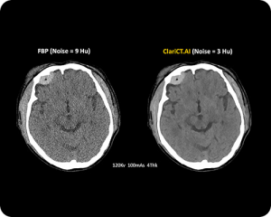 CT-Scan
