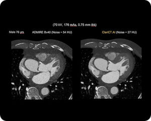 Computed Tomography-image