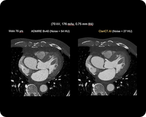 CT-Scan