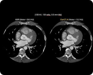 Computed Tomography-image