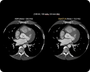 CT-Scan