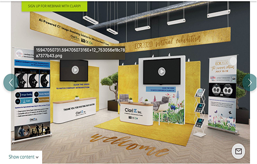 RSNA-Exhibition-ClariPi