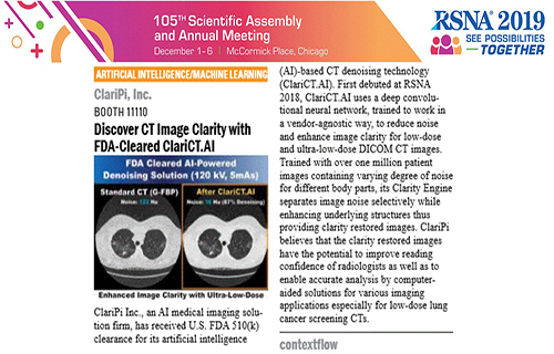 RSNA-Exhibition-ClariPi