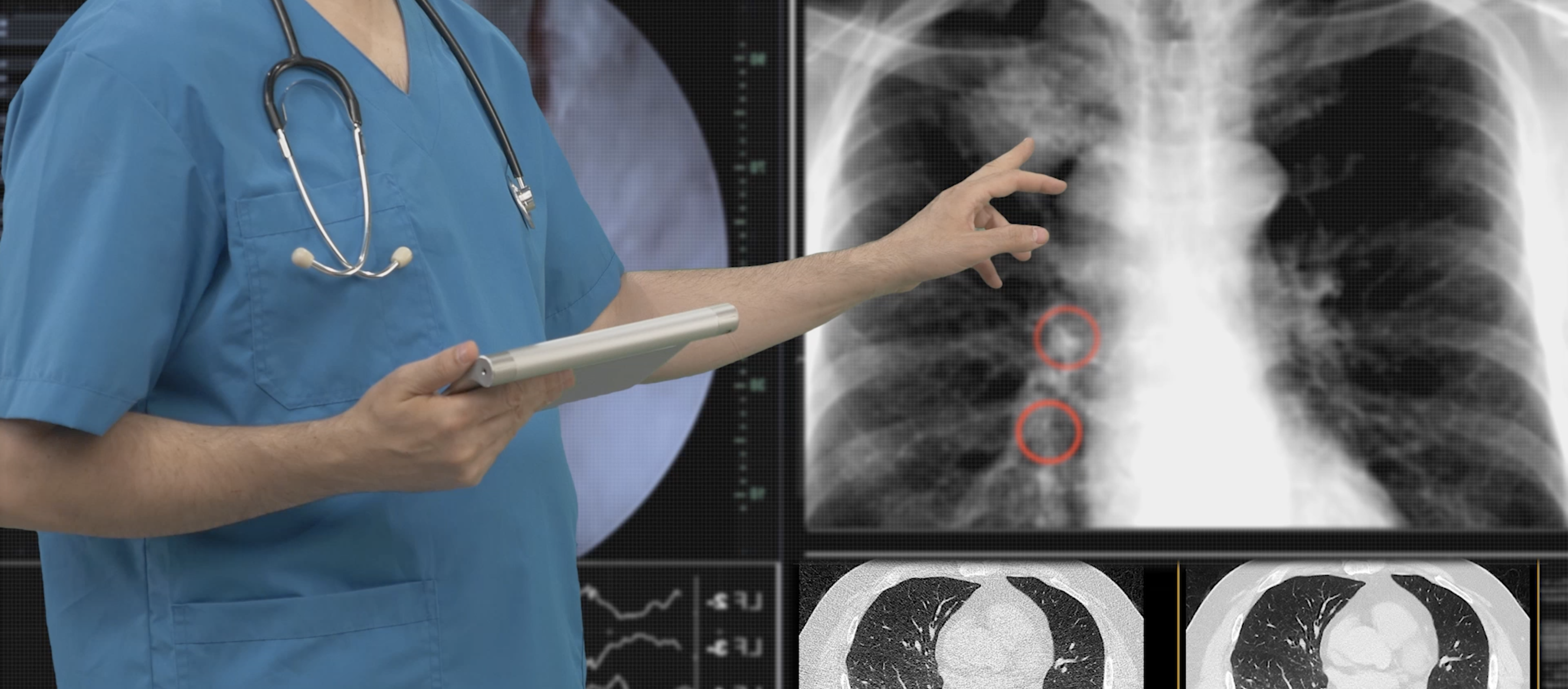 medical-procedure-image